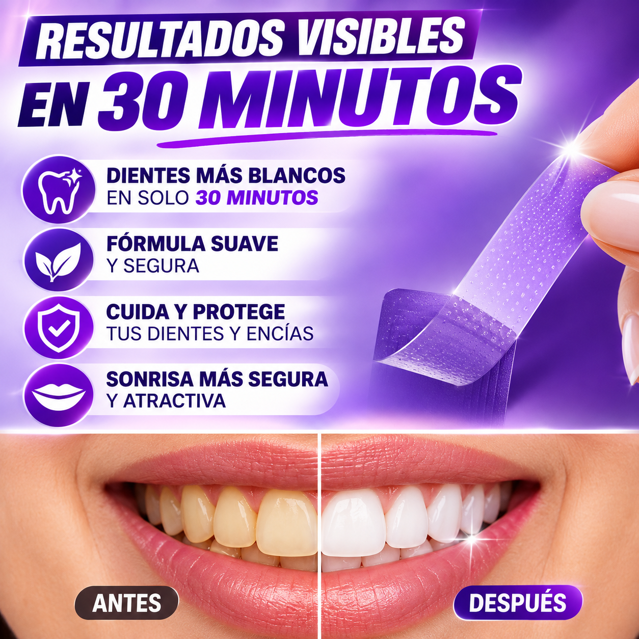 Antes y después blanqueamiento dental